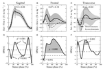 Impact of Knee Modeling Approach on Indicators and Classification of Anterior Cruciate Ligament Injury Risk: